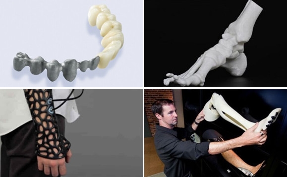 Medical / Prosthetic Medical / Prosthetic